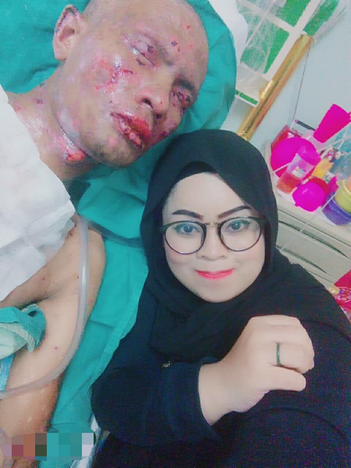 “Doakanlah Suami Saya Dapat Melihat Seperti Dulu Walau Hanya Sebelah Mata…”