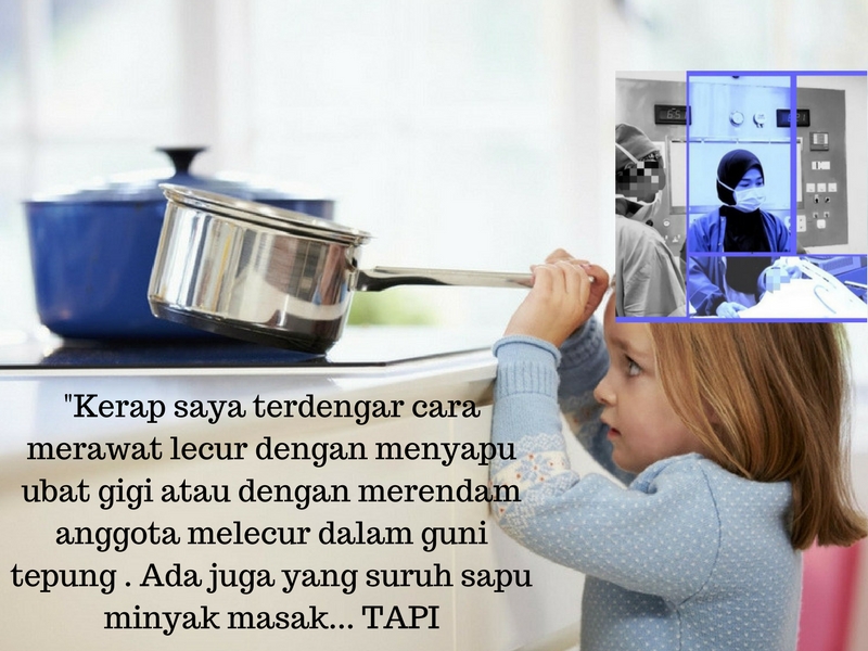 Jangan Panik Bila Anak Melecur Kena Air Panas, Perlu Tahu Rawatan Kecemasan Yang Betul, Elak Jadi Lebih Teruk