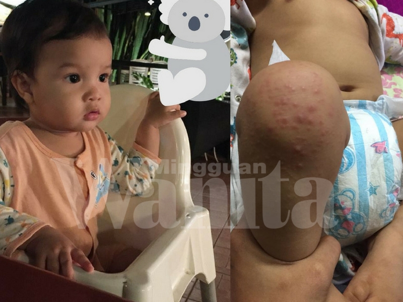 Hati-hati Masukkan Anak Dalam Baby Chair Di Tempat Awam, Kita Takkan Tahu Kat Situ Berkumpulnya Virus HFMD