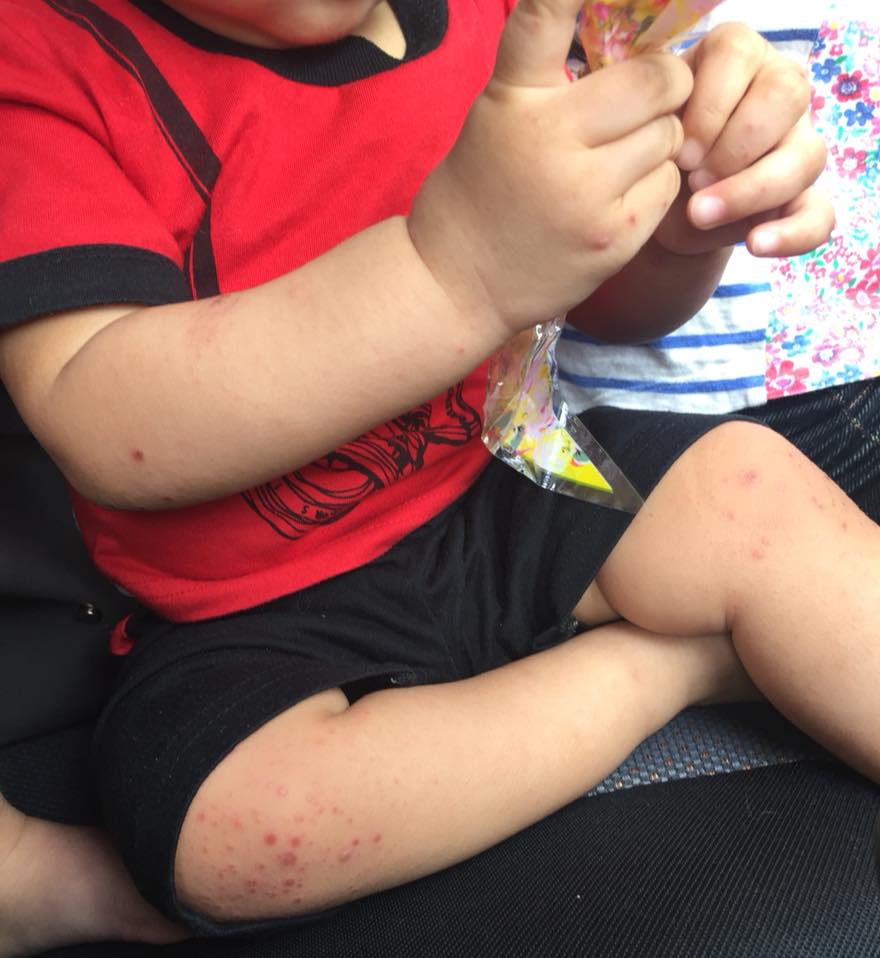 Hati-hati Masukkan Anak Dalam Baby Chair Di Tempat Awam, Kita Takkan Tahu Kat Situ Berkumpulnya Virus HFMD