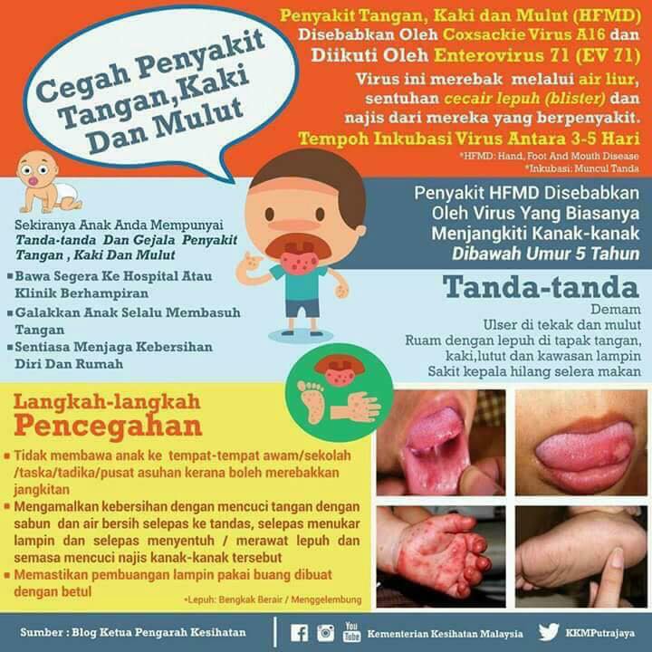 Hati-hati Masukkan Anak Dalam Baby Chair Di Tempat Awam, Kita Takkan Tahu Kat Situ Berkumpulnya Virus HFMD