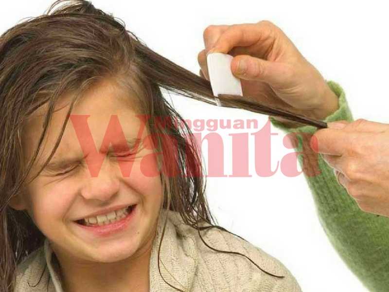 3 Punca Rambut Anak Ada Kutu &#038; Atasinya Dengan 5 Petua Mudah Hanya Guna Bahan Semula Jadi