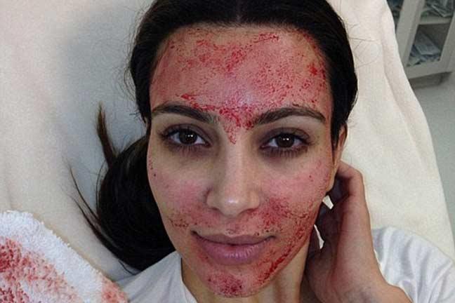 6 Kaedah Rawatan Kecantikan Wajah Ini Agak Pelik, Hanya Wanita Berhati ‘Kental’ BERANI Mencubanya!